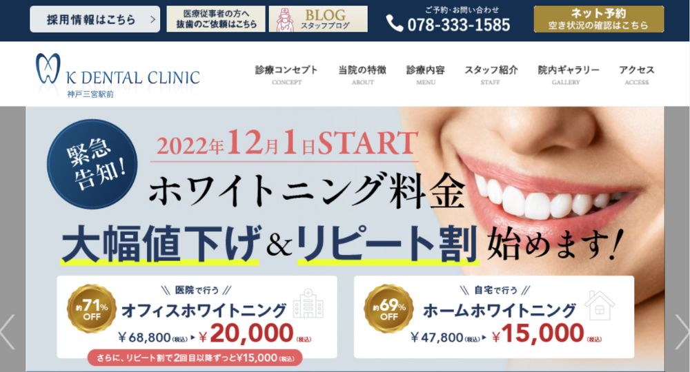 三宮のホワイトニングインプラントK-DENTAL-CLINIC